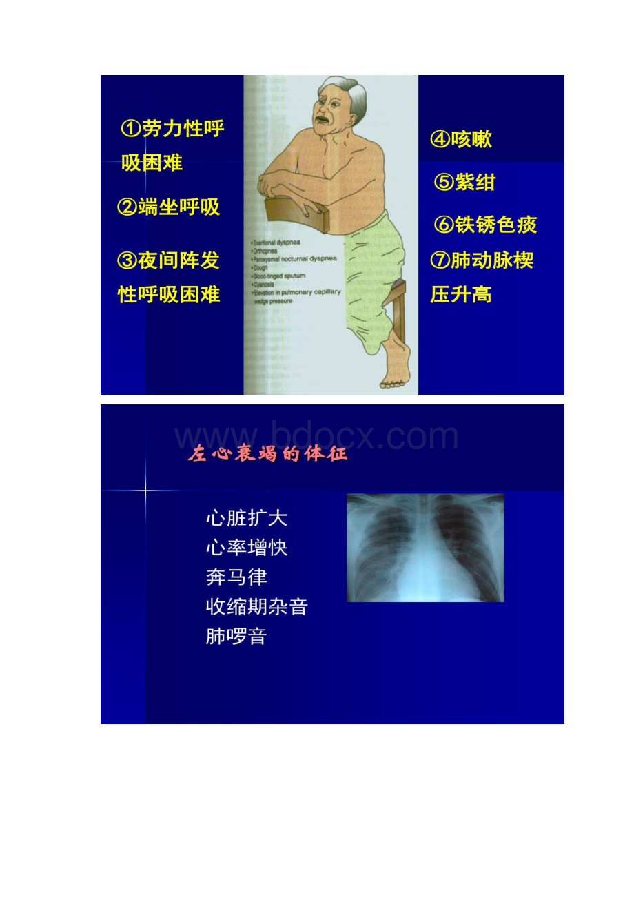 心力衰竭病例讨论Word文档格式.docx_第2页