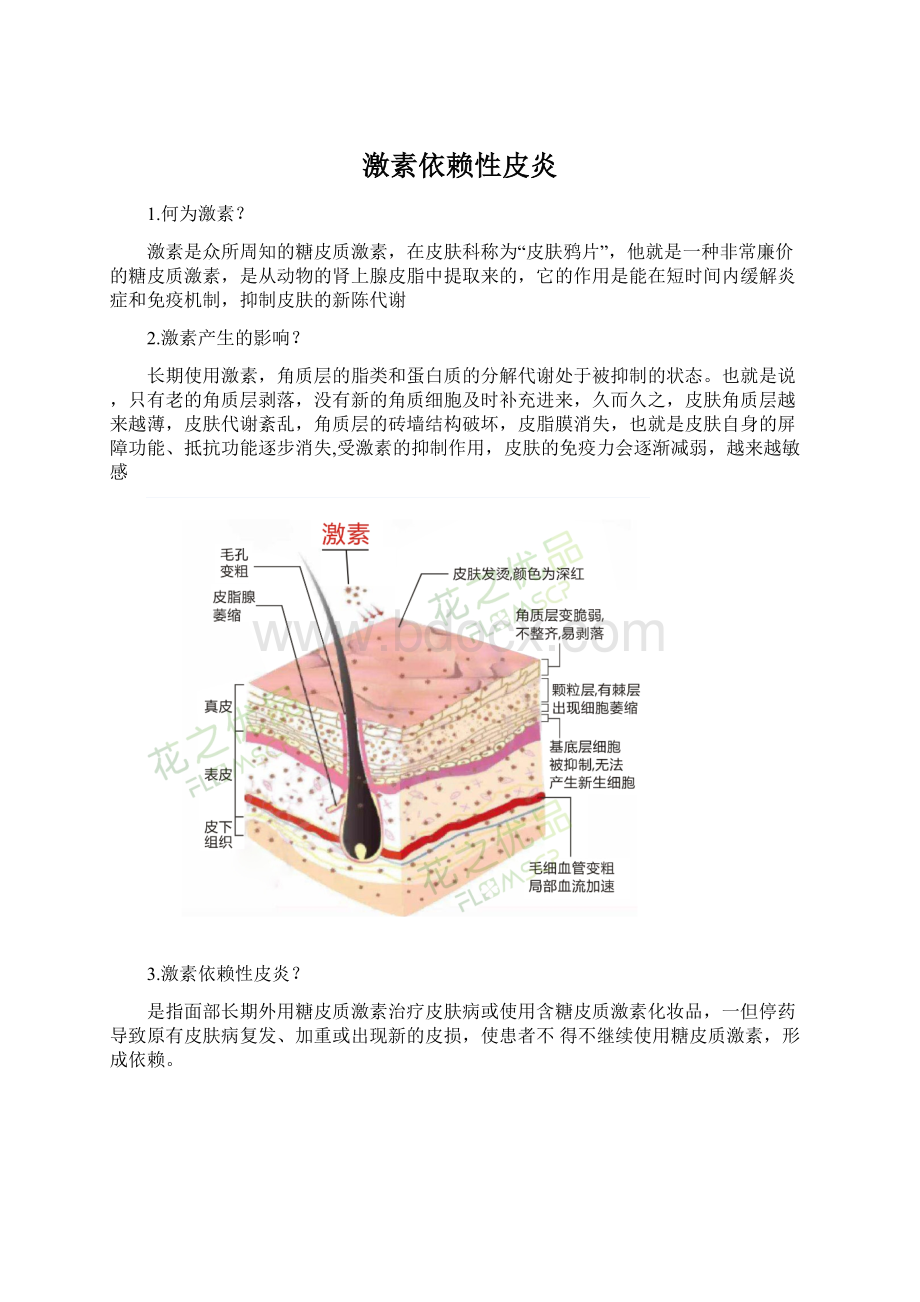 激素依赖性皮炎.docx