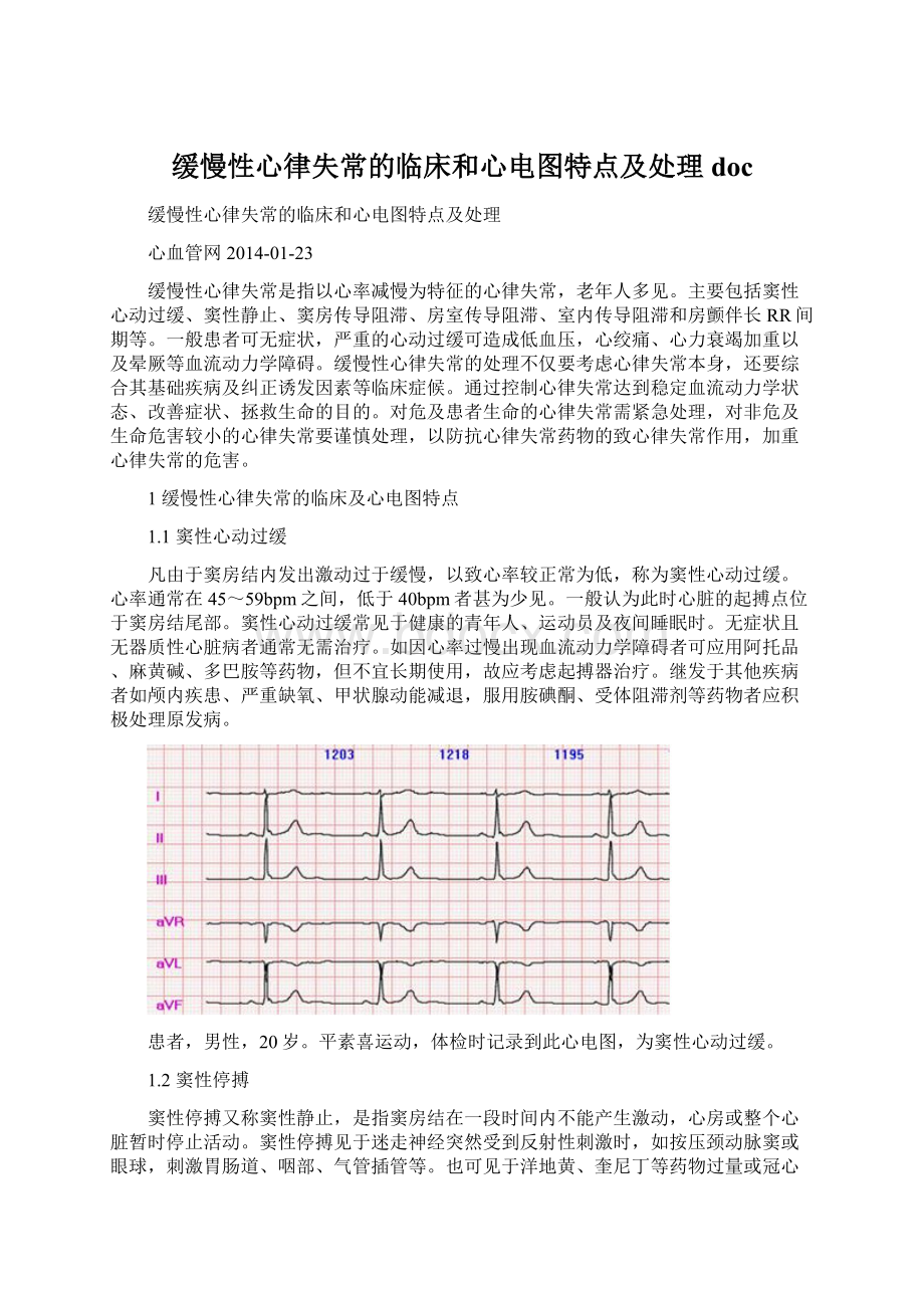 缓慢性心律失常的临床和心电图特点及处理doc.docx