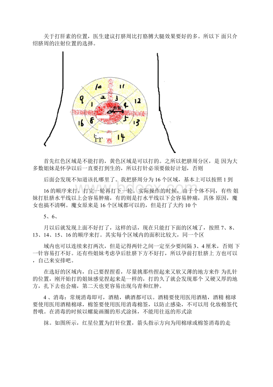 肝素的注射方法 1Word格式文档下载.docx_第3页