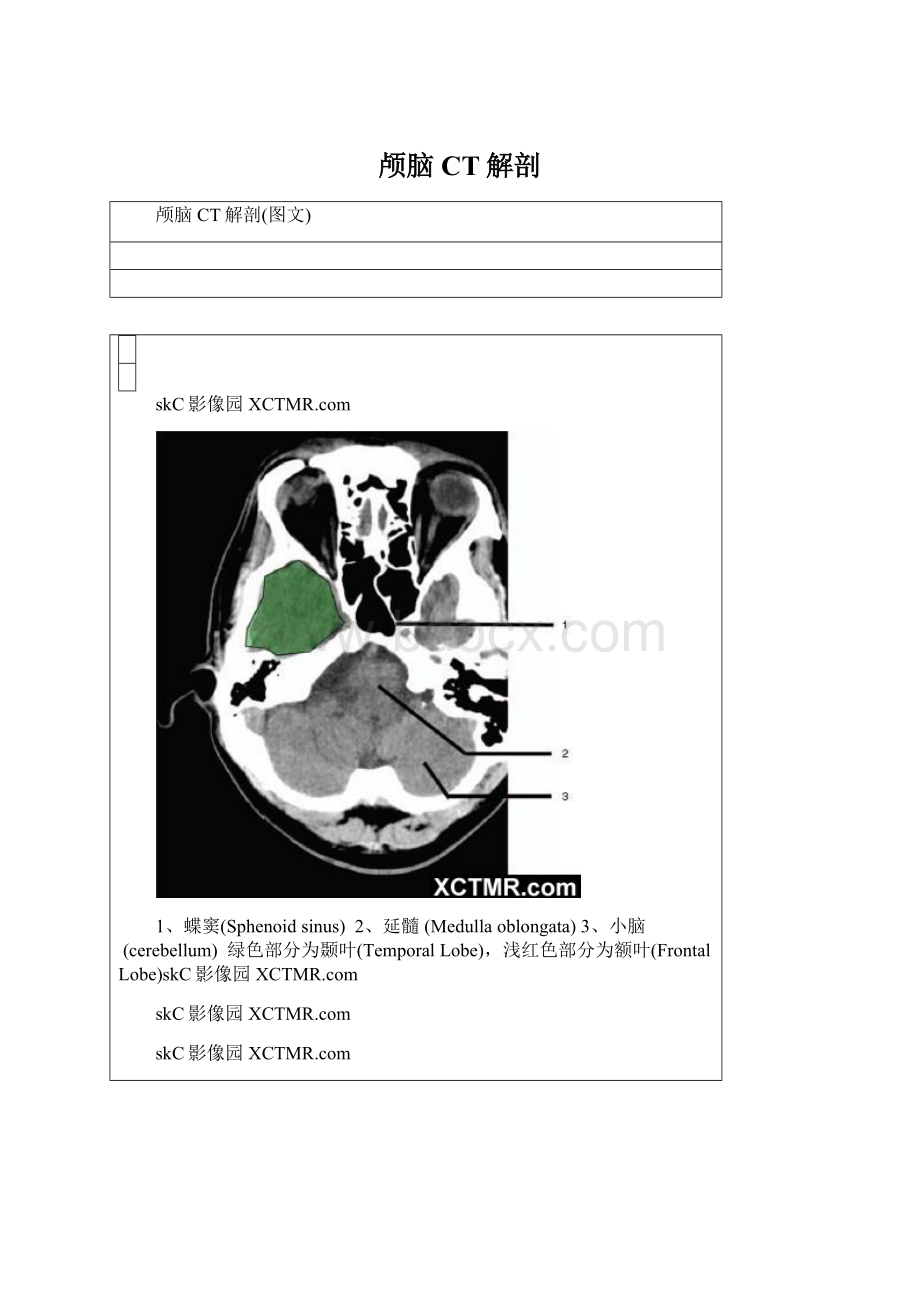 颅脑CT解剖.docx_第1页