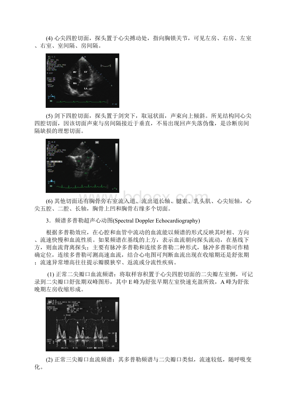 超声诊断学教程 第二章超声心动图学.docx_第3页