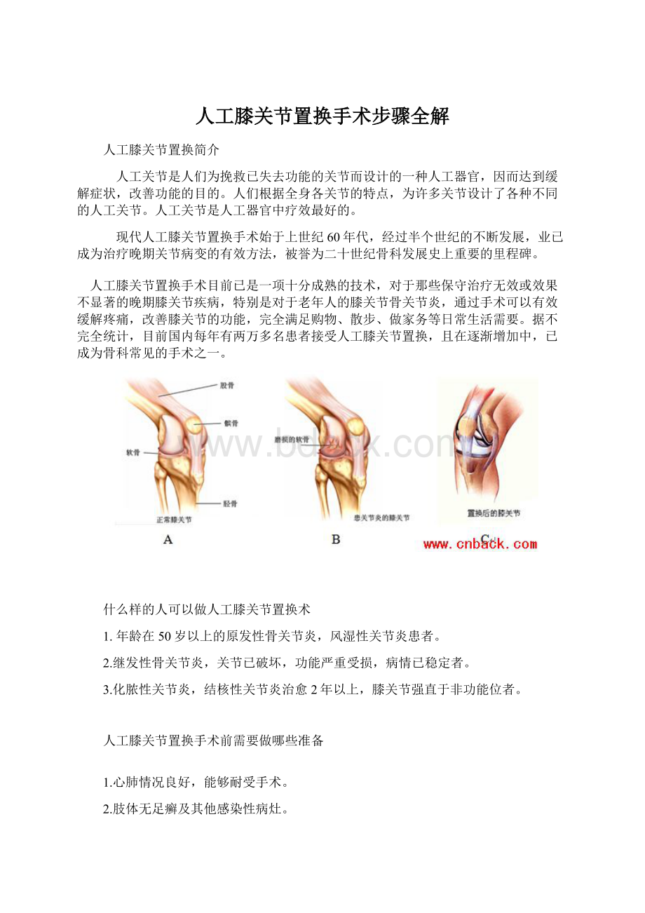 人工膝关节置换手术步骤全解.docx_第1页