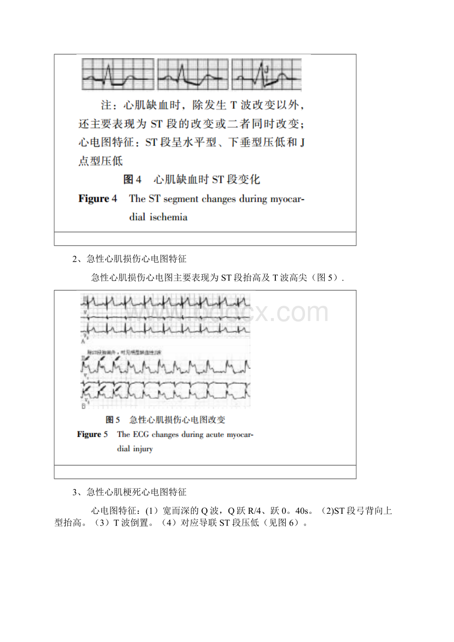 详解临床常见心电图危急值识别.docx_第3页