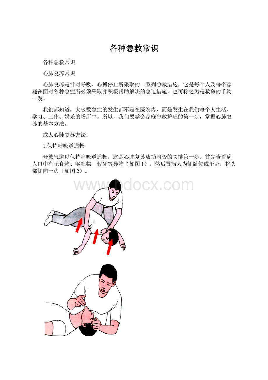 各种急救常识Word格式文档下载.docx