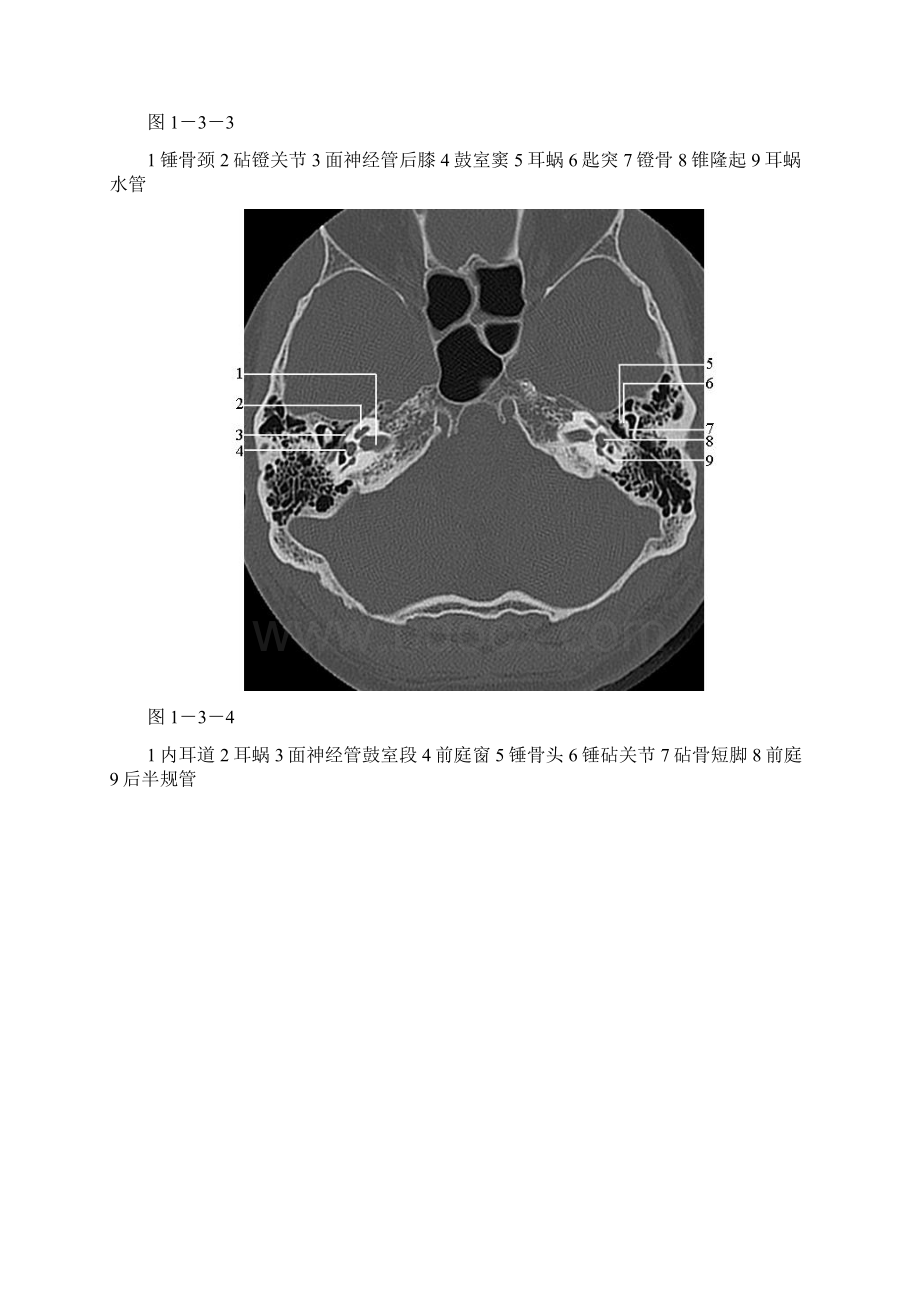 颞骨正常CT解剖.docx_第3页