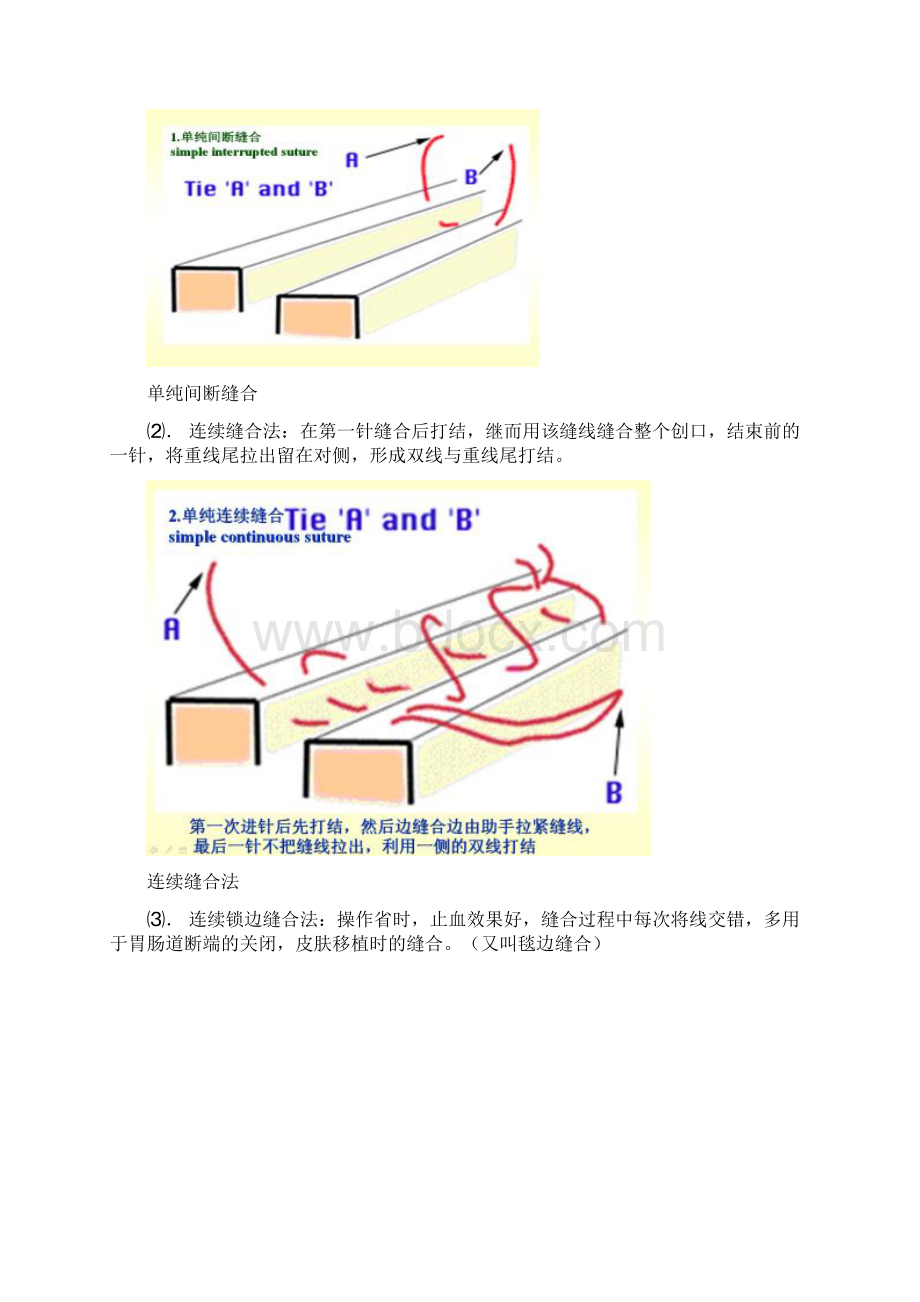 外科缝合文档格式.docx_第3页