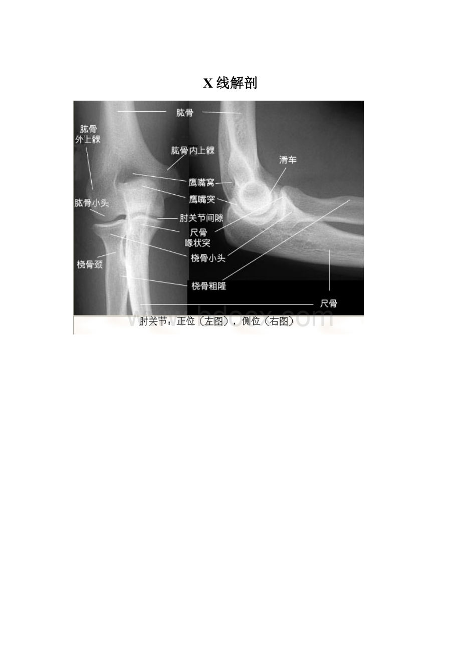 X线解剖.docx_第1页