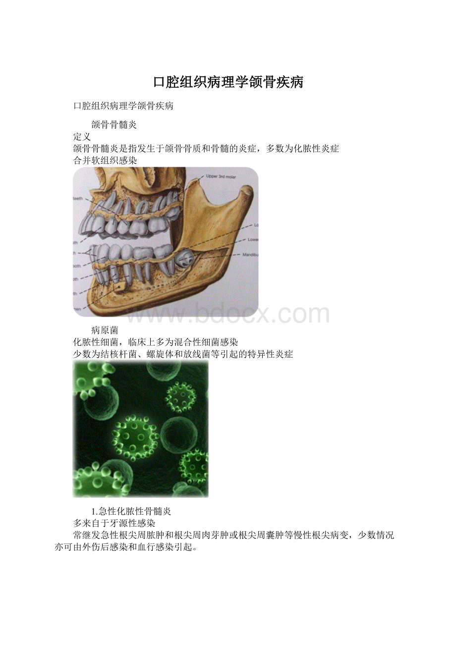 口腔组织病理学颌骨疾病Word格式.docx_第1页