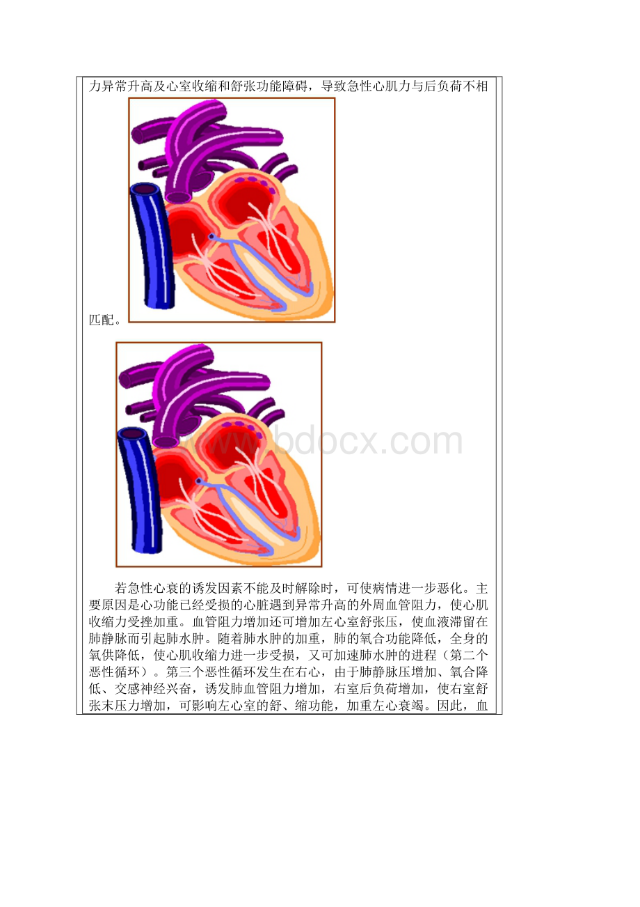 最新心衰患者围麻醉期管理.docx_第3页