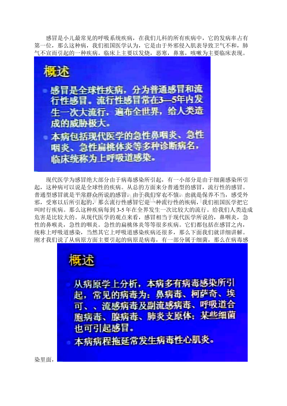 中医儿科学感冒 精品课堂赵坤.docx_第2页