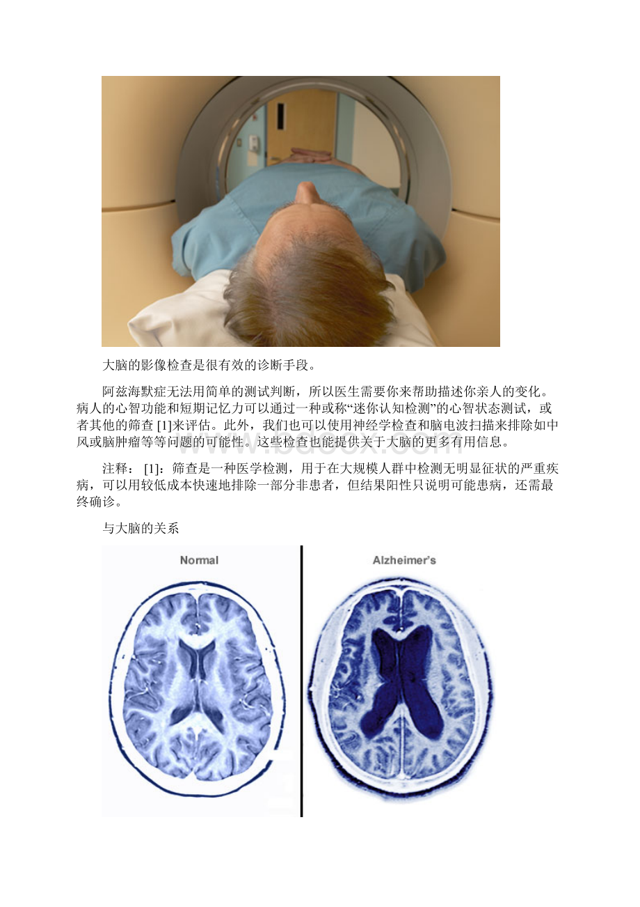 阿金森症状及护理当你爱的人认不出你Word下载.docx_第2页