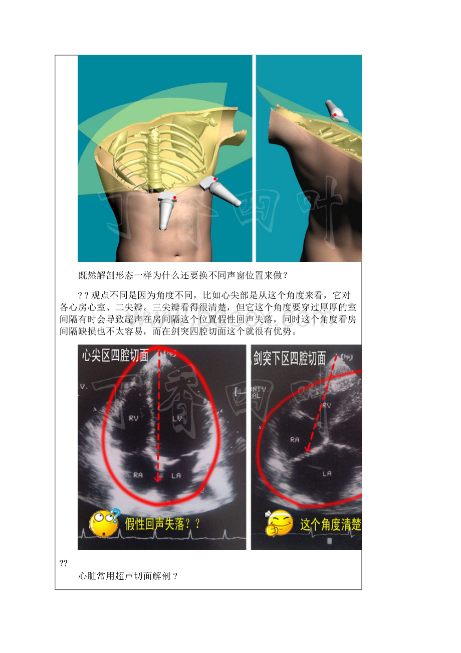 3D图解心脏解剖与心脏超声切面.docx_第3页