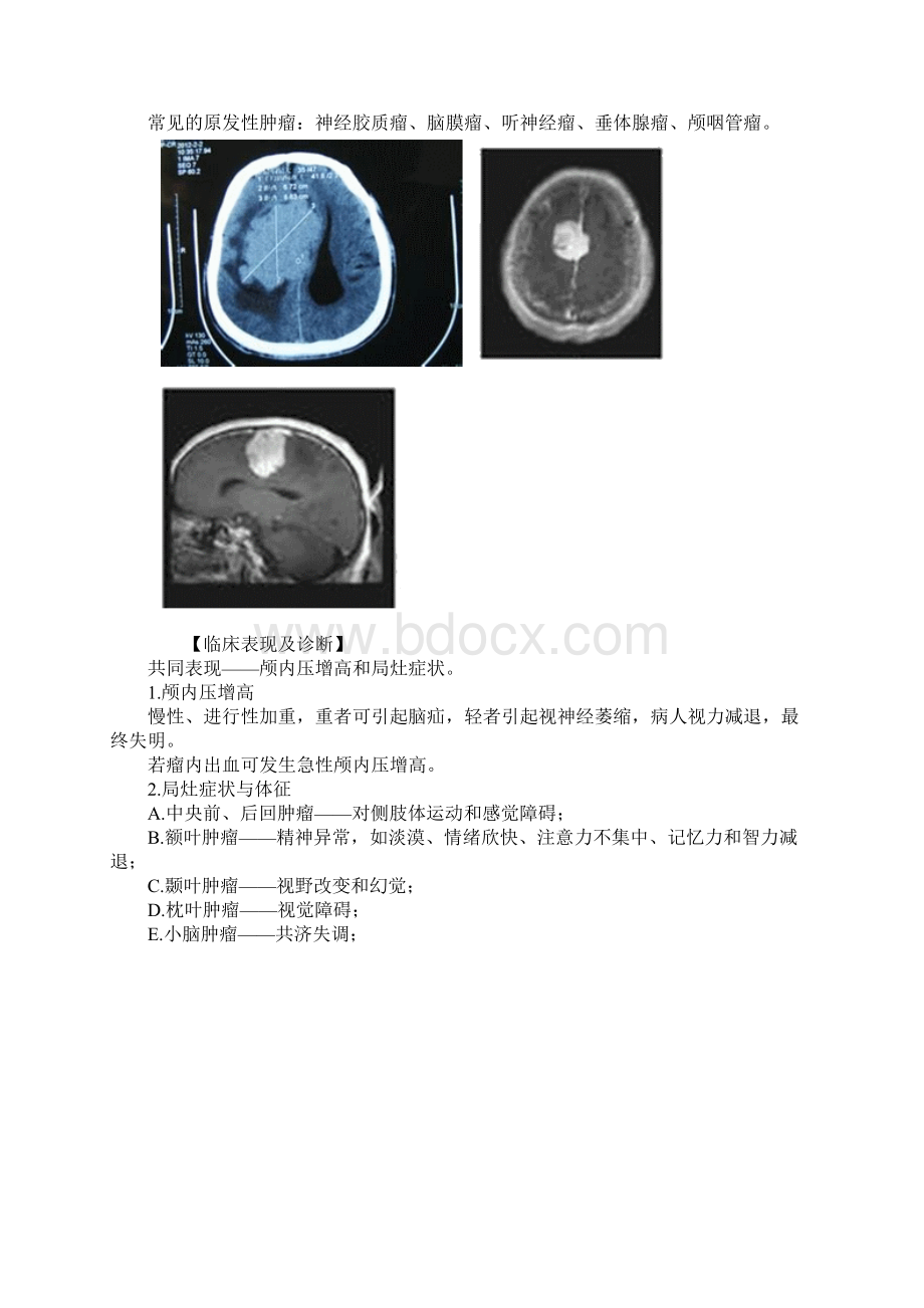 主管护师考试辅导外科护理学30.docx_第2页