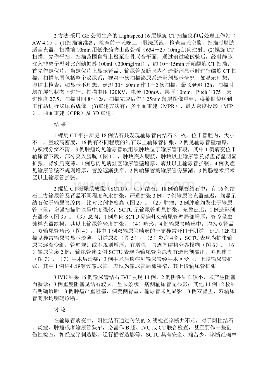 多排螺旋CT泌尿系成像在输尿管病变诊断中的应用Word文件下载.docx_第2页