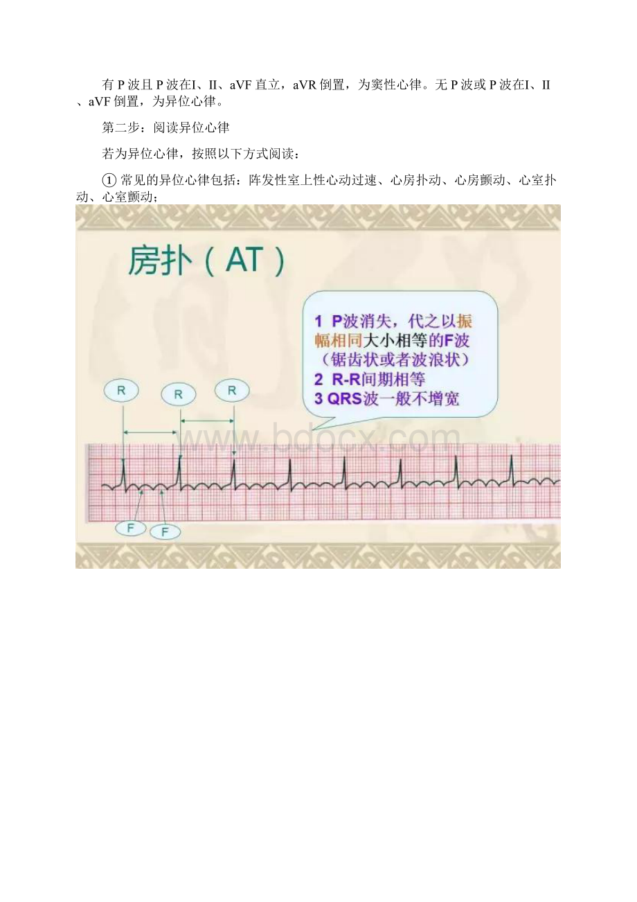 心电图的诊断思路及技巧Word文档下载推荐.docx_第2页