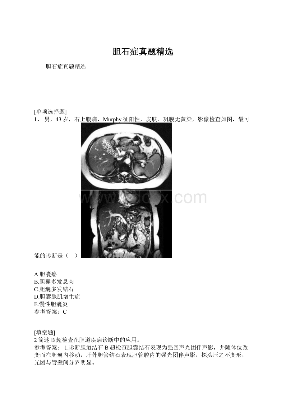 胆石症真题精选文档格式.docx_第1页