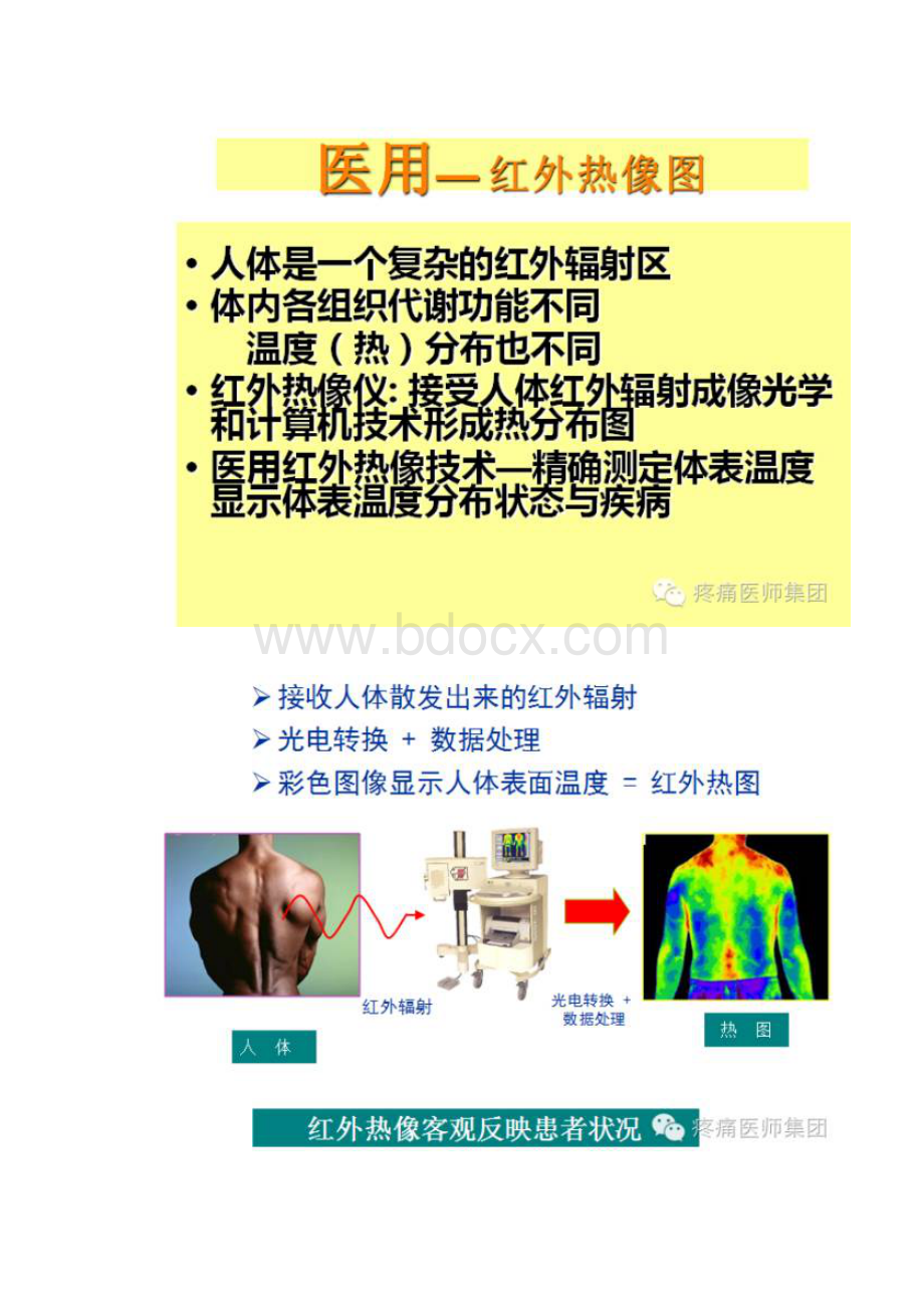 红外检测在疼痛科的作用.docx_第3页