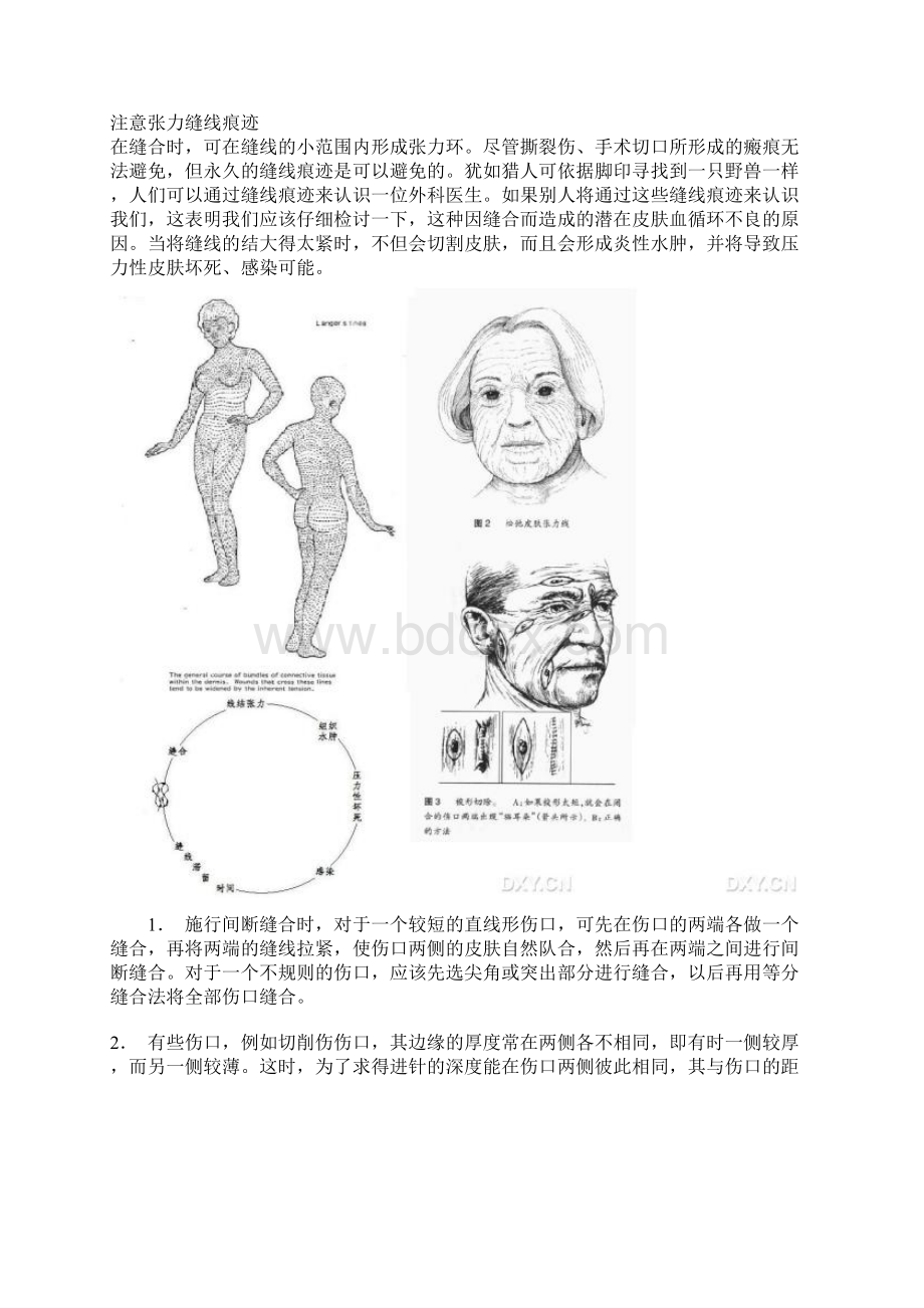 米拉德缝合技巧要点.docx_第3页