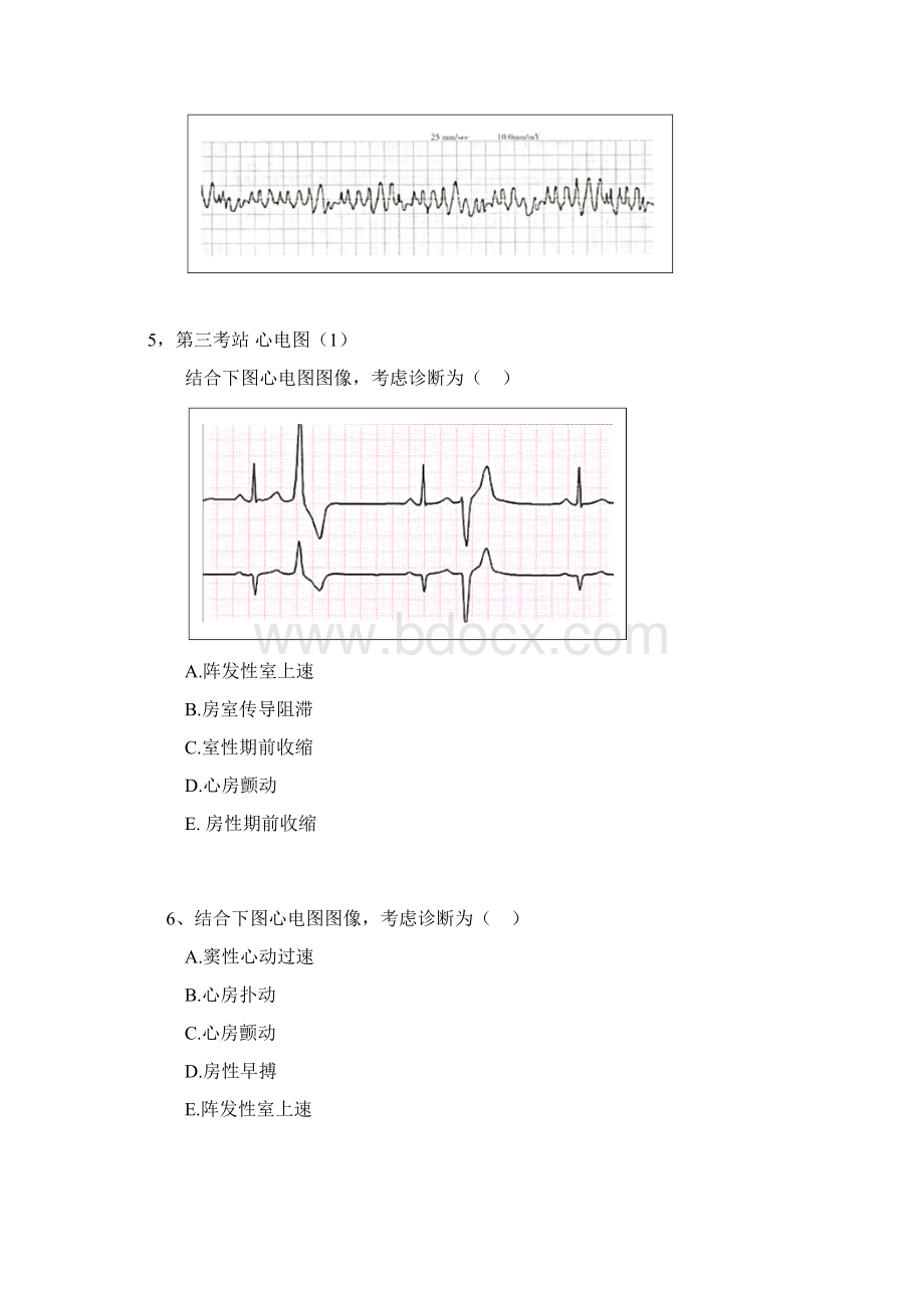 心电图.docx_第3页