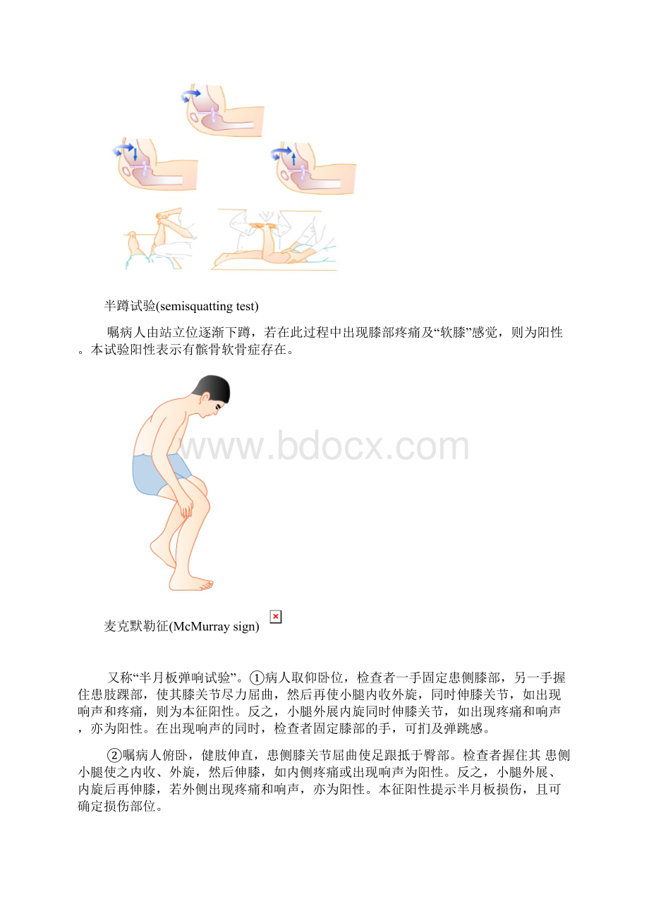 膝关节检查试验Word文档下载推荐.docx_第2页