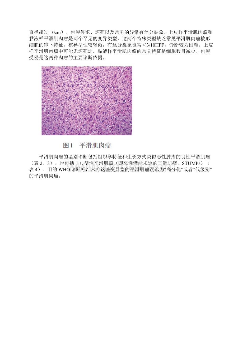 FIGO子宫肉瘤诊治指南解读全文.docx_第3页