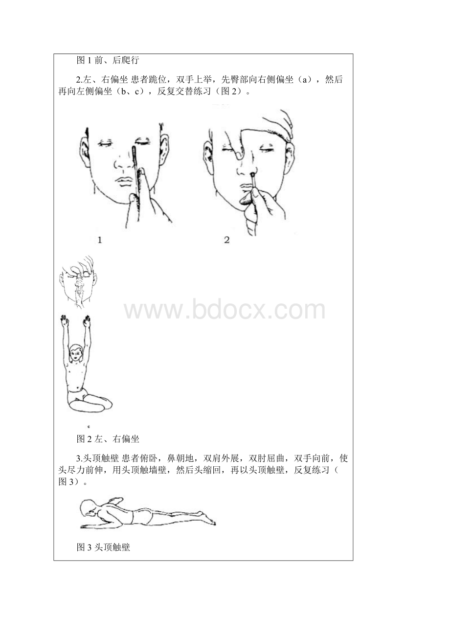 脊柱侧弯凸的治疗方法及矫形器支具的配置Word文件下载.docx_第2页