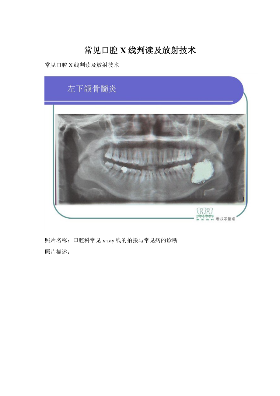 常见口腔X线判读及放射技术.docx