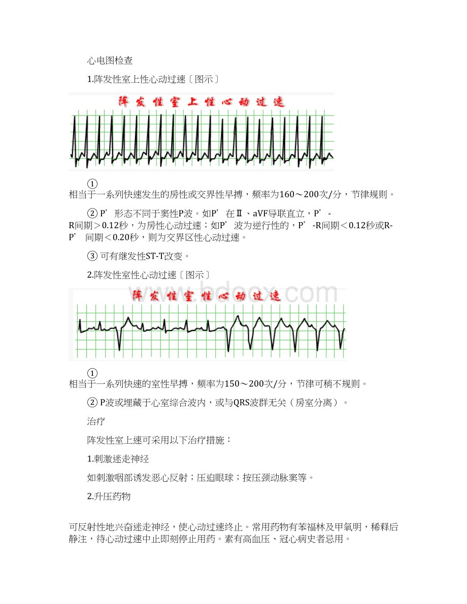 循环系统疾病常见心律失常阵发性心动过速.docx_第2页