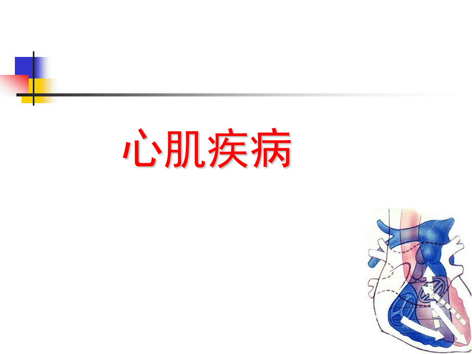 心肌疾病.ppt_第1页