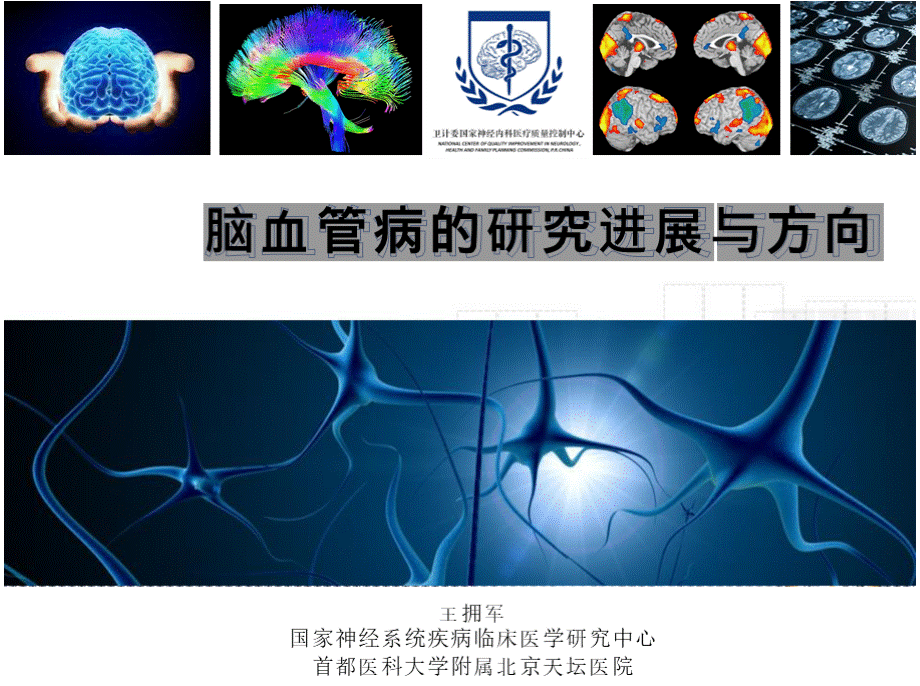 脑血管病的研究进展与方向 王拥军PPT文件格式下载.pptx