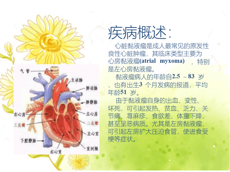 心脏黏液瘤PPT课件.pptx_第3页