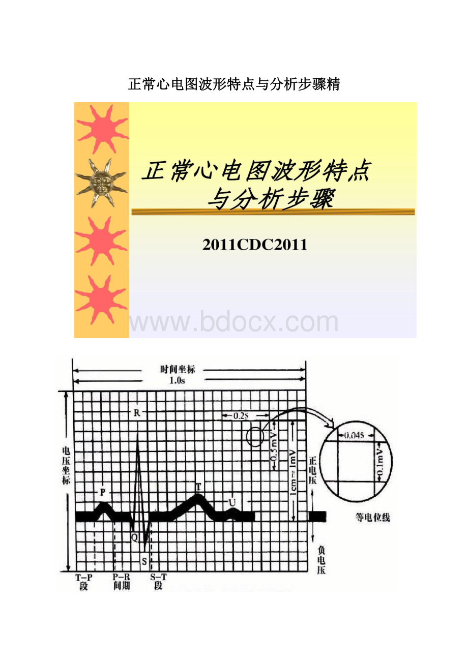 正常心电图波形特点与分析步骤精Word格式文档下载.docx_第1页