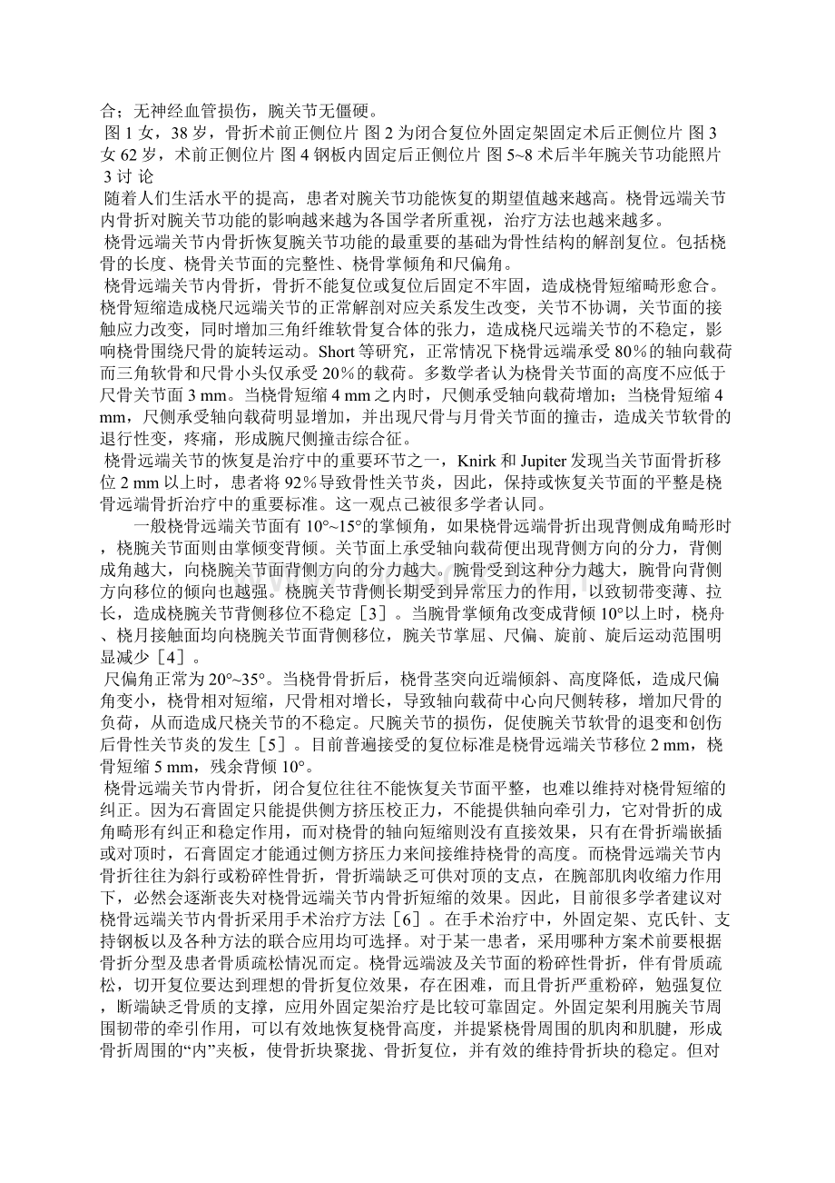 桡骨远端关节内骨折的手术治疗.docx_第2页