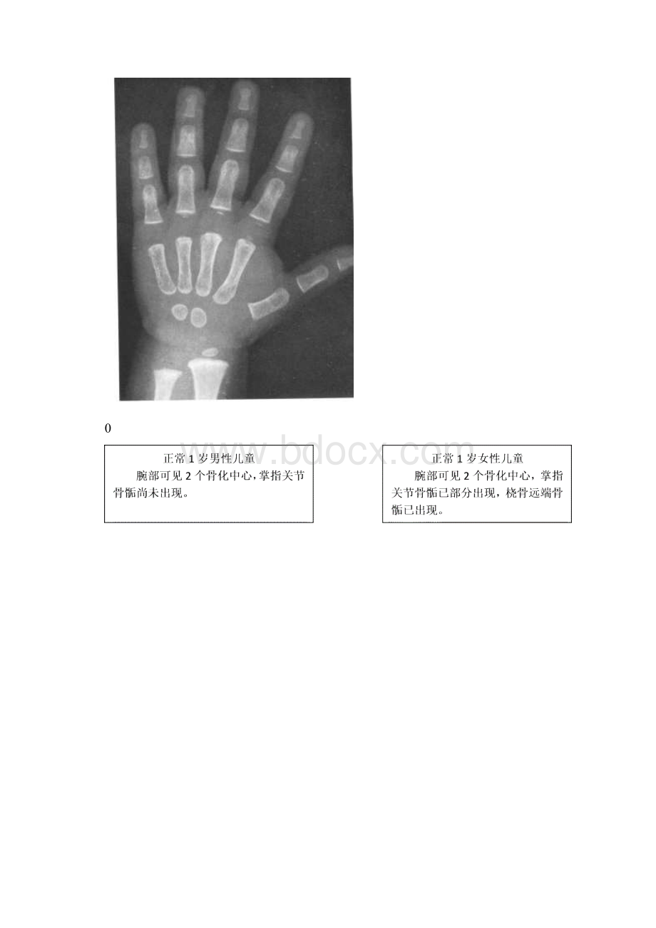 骨龄之对照标准借鉴资料.docx_第2页