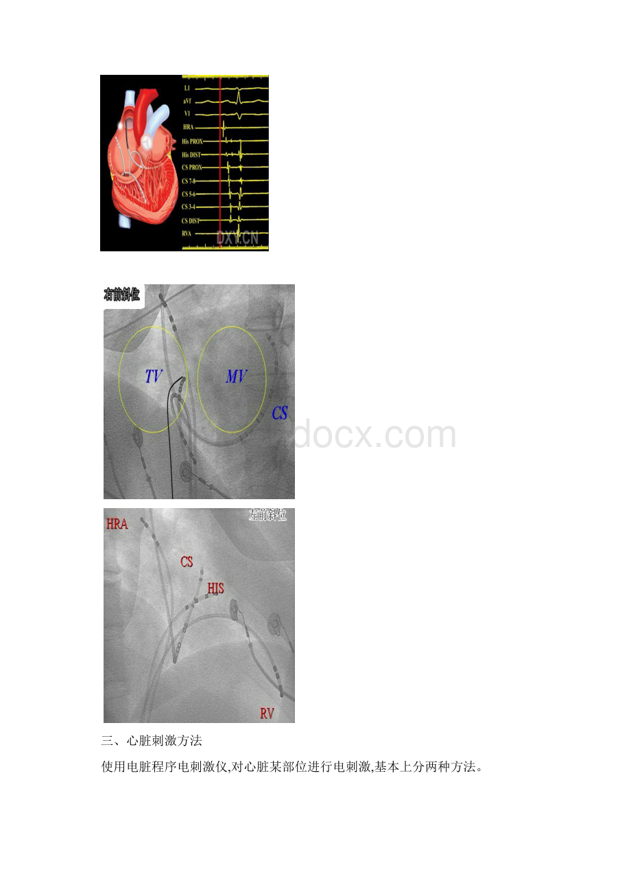 第8章心内电生理检查Word格式.docx_第3页