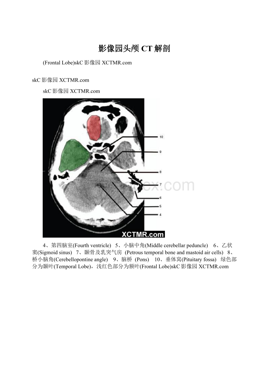 影像园头颅CT解剖.docx_第1页