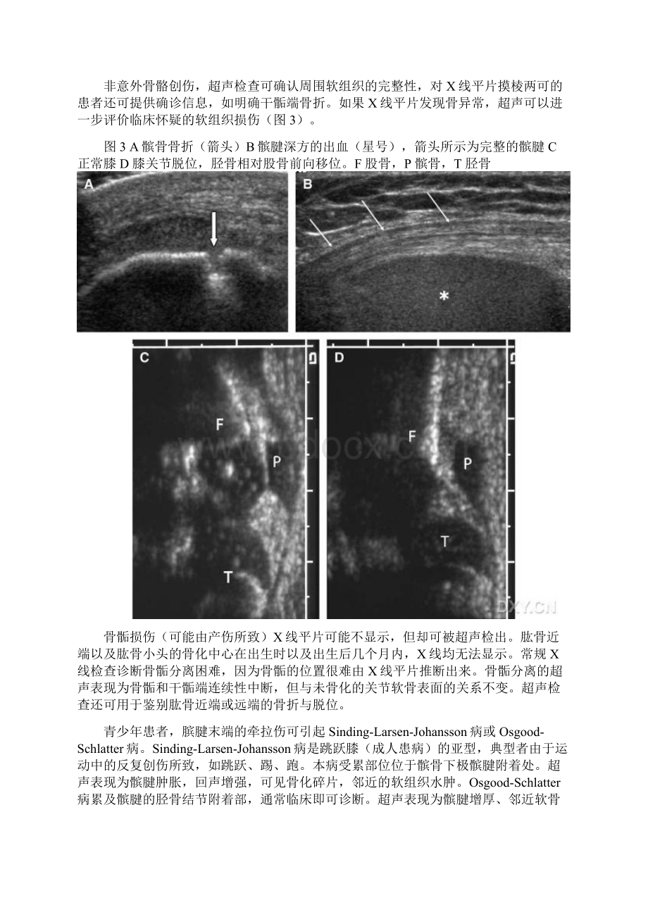 四肢痛的超声检查.docx_第3页