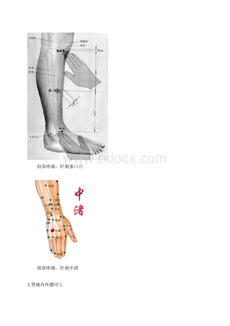 各种疼痛的针灸治疗穴位《配图片》超好用.docx_第3页