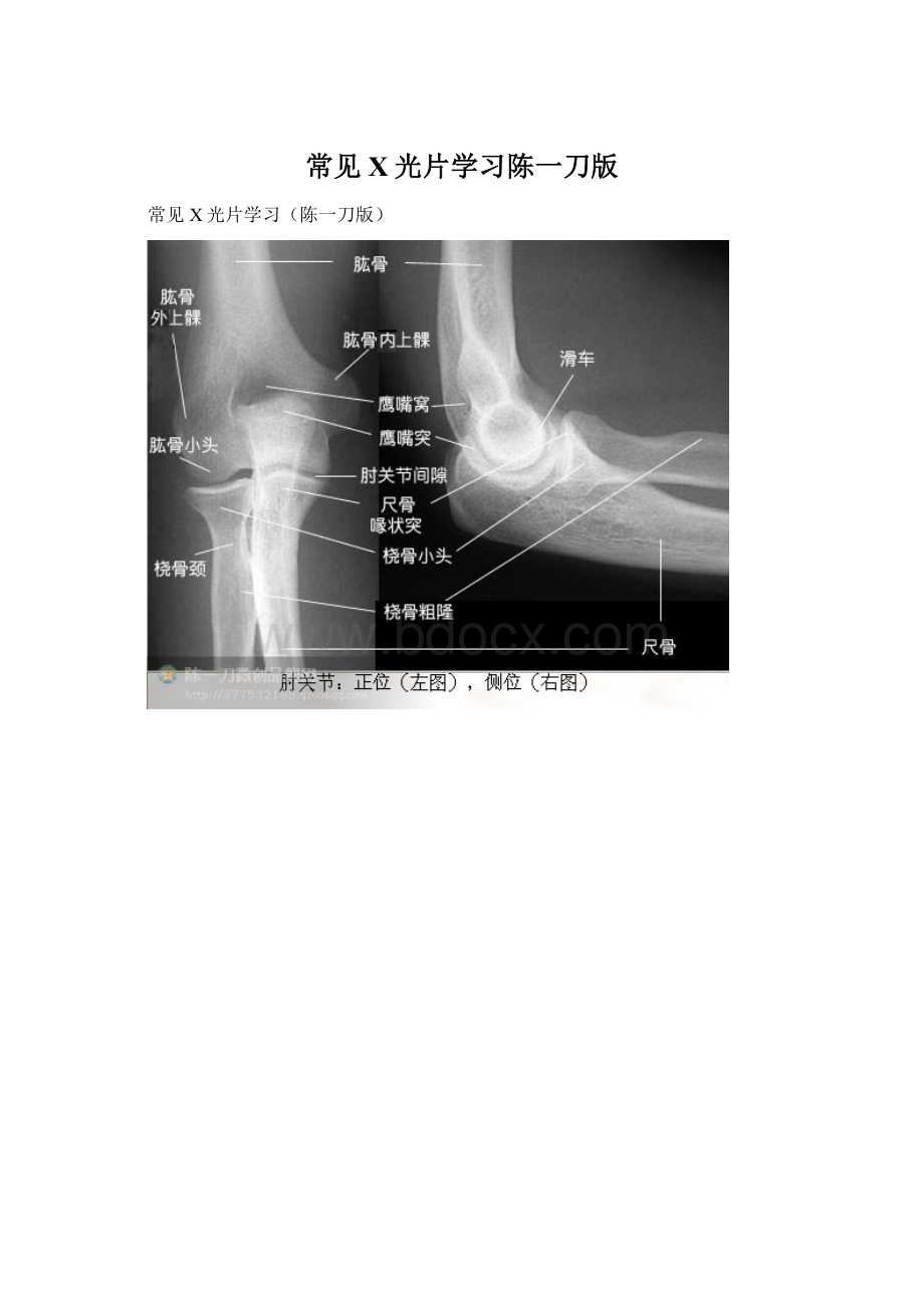 常见X光片学习陈一刀版.docx_第1页