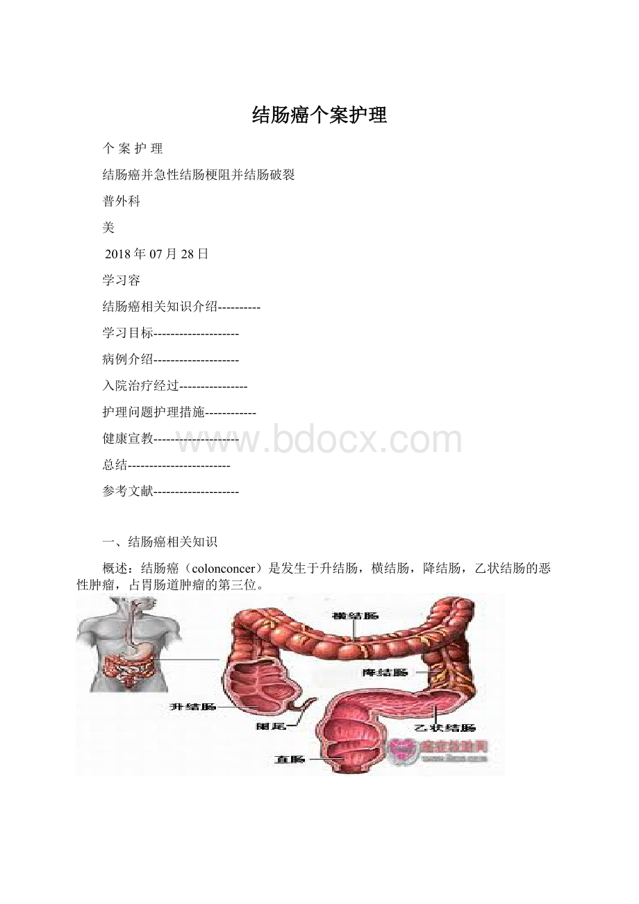 结肠癌个案护理.docx_第1页