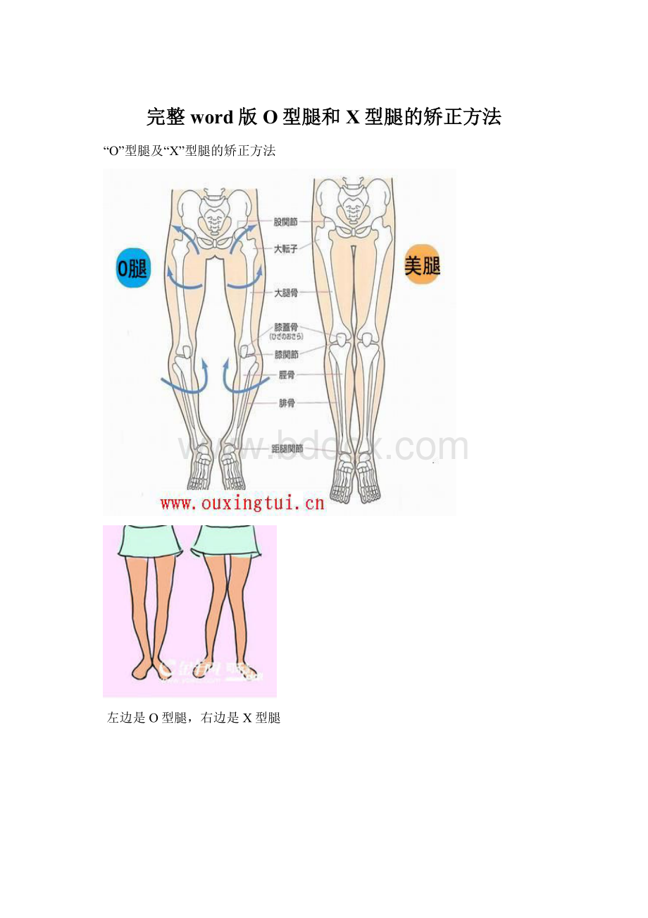 完整word版O型腿和X型腿的矫正方法.docx