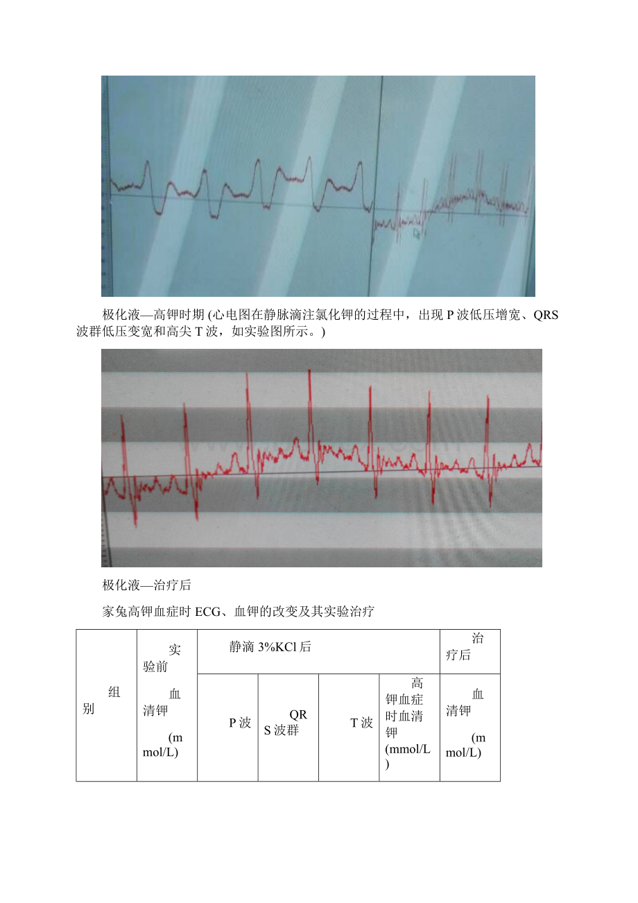 机能实验工作报告高血钾Word文档格式.docx_第3页