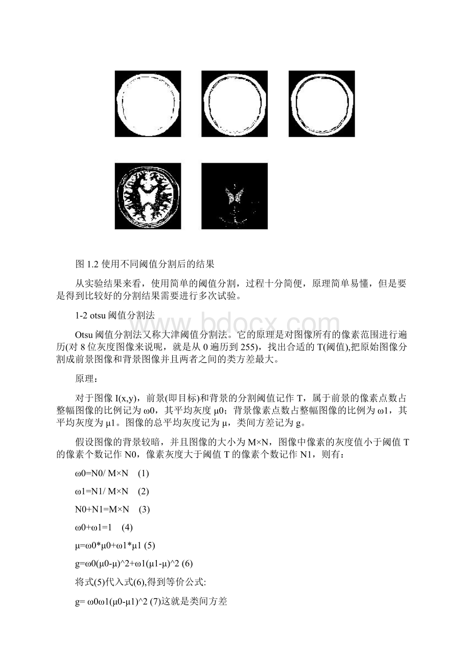 医学图像分割方法汇总.docx_第2页