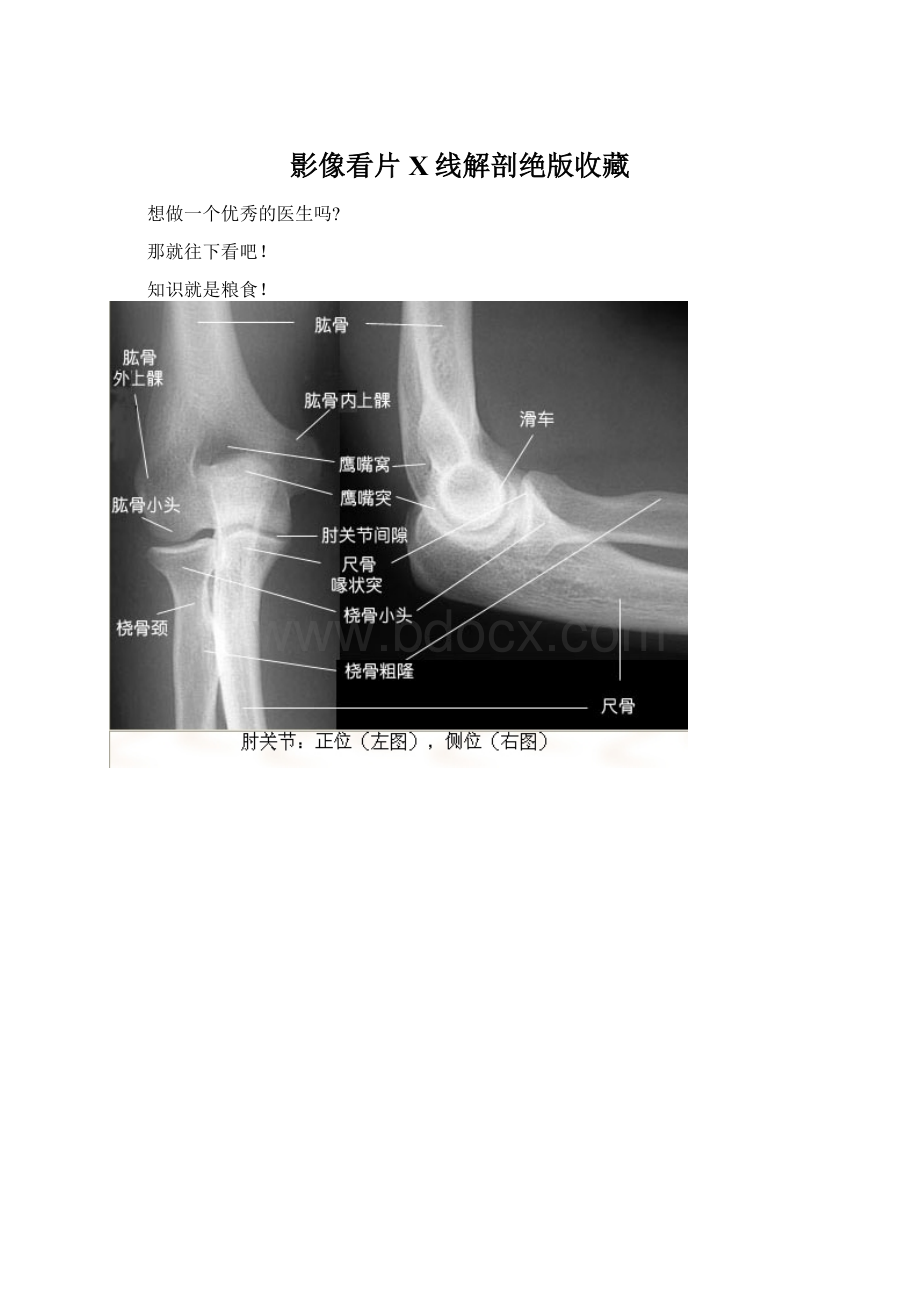 影像看片X线解剖绝版收藏Word文档下载推荐.docx