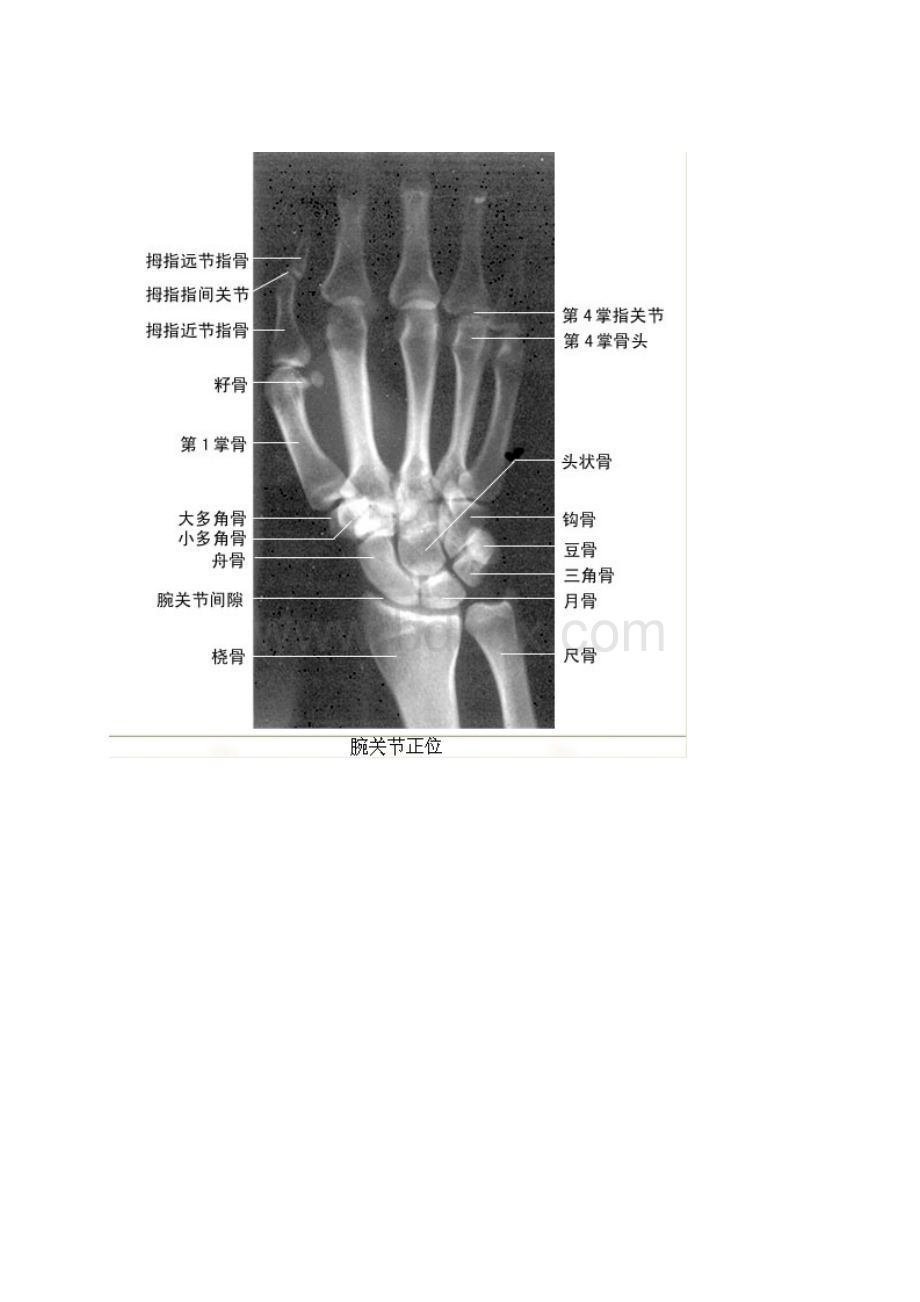 影像看片X线解剖绝版收藏Word文档下载推荐.docx_第2页