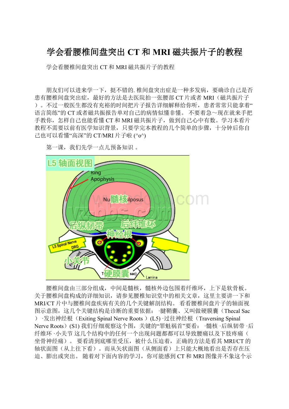 学会看腰椎间盘突出CT和MRI磁共振片子的教程.docx