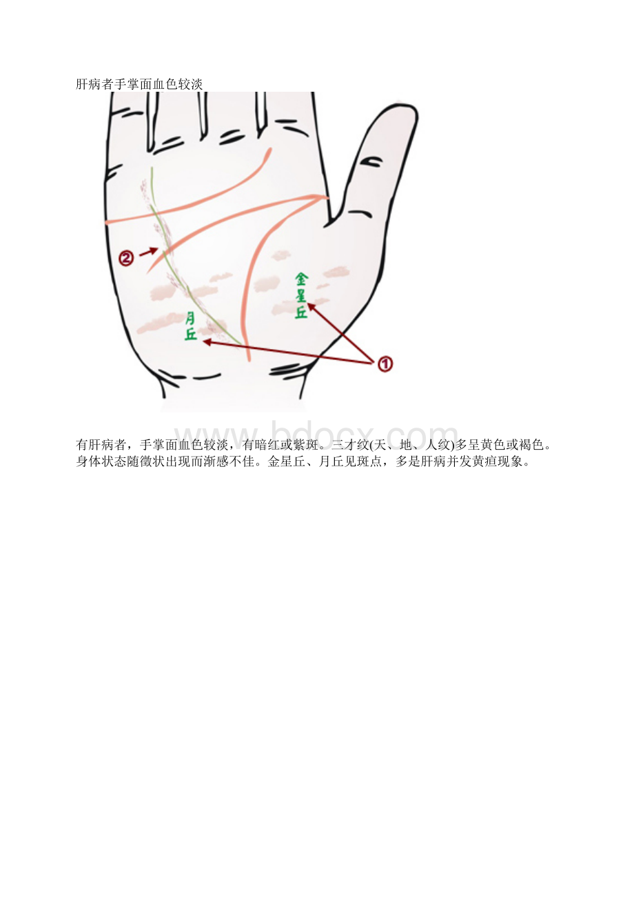 手相看病.docx_第2页