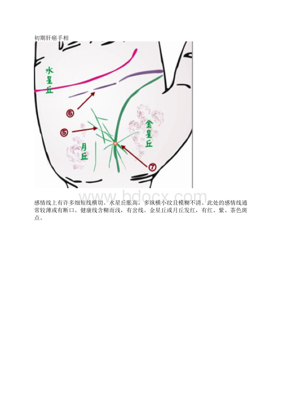 手相看病.docx_第3页