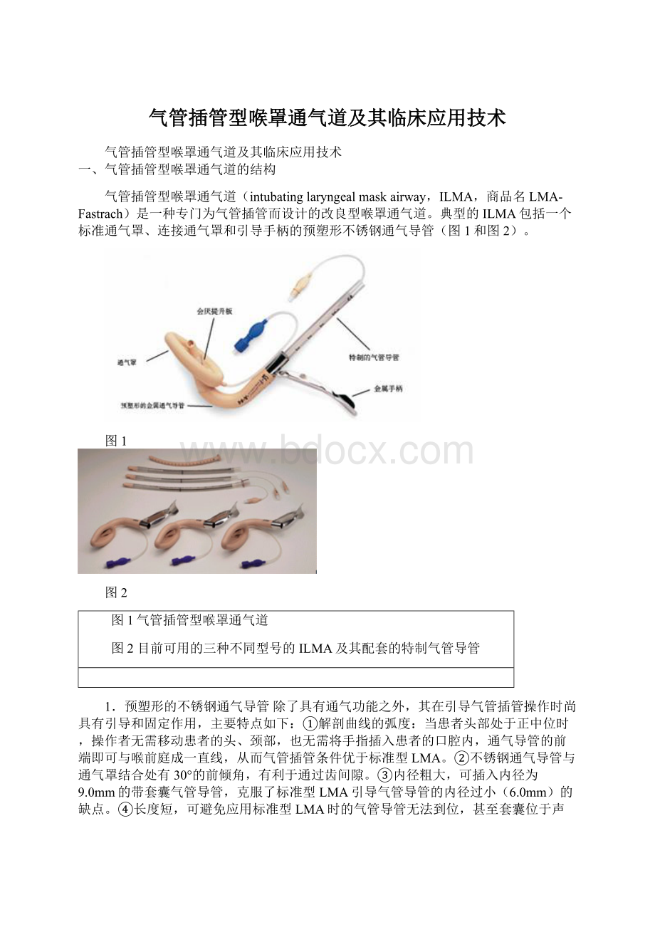 气管插管型喉罩通气道及其临床应用技术.docx_第1页